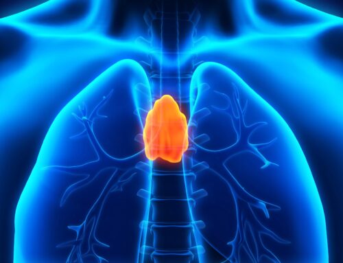 Timoma: el cáncer torácico que se disfraza de resfrío