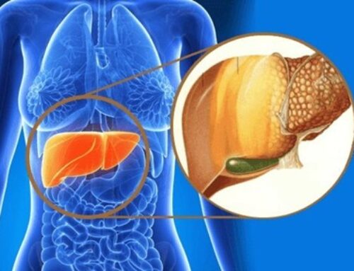 Testosterona baja y fructosa: riesgo de hígado graso