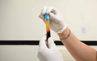 imagen de un tubo de laboratorio conteniendo sangre ya procesada para separar el plasma para uso en dermatología