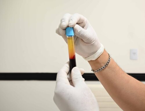 Cuáles son los beneficios del plasma rico en plaquetas en dermatología